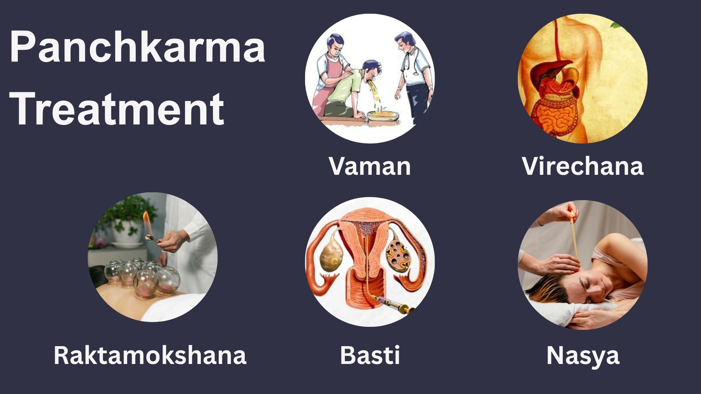 Panchkarma Treatment in Ahmedabad